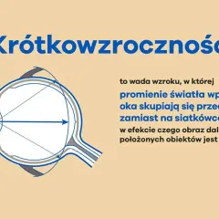 Krótkowzroczność: przyczyny i objawy, które mogą cię zaskoczyć