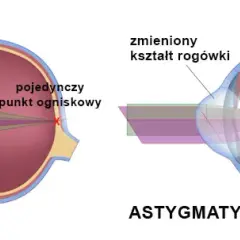 Czy wada wzroku to choroba? Poznaj prawdę o problemach ze wzrokiem