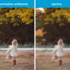 Czy przy zaćmie boli oko? Odkryj prawdę o bólu oczu