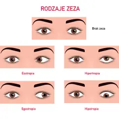 Zez ukryty u dziecka objawy: jak je rozpoznać i kiedy działać