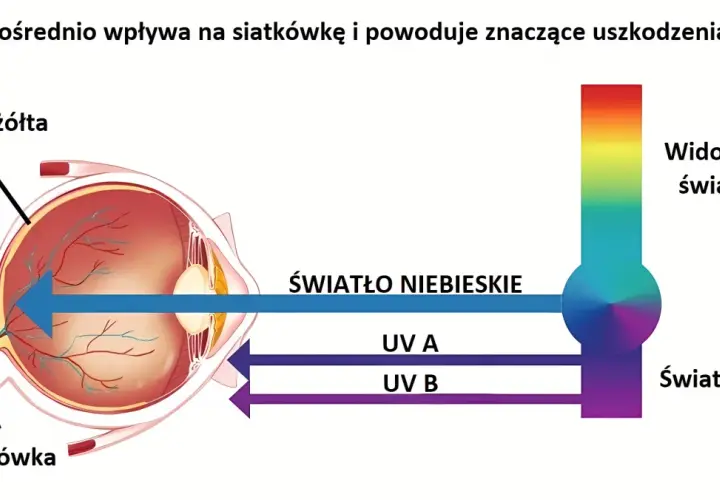 Czy telewizor emituje niebieskie światło? Sprawdź skutki dla zdrowia