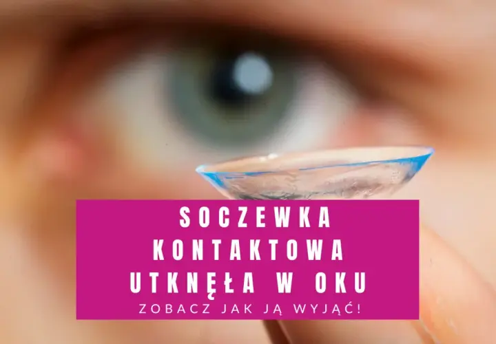 Jak bezpiecznie sprawdzić czy soczewka jest w oku - skuteczne metody kontroli
