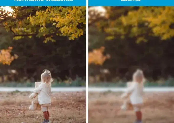Czy przy zaćmie boli oko? Odkryj prawdę o bólu oczu