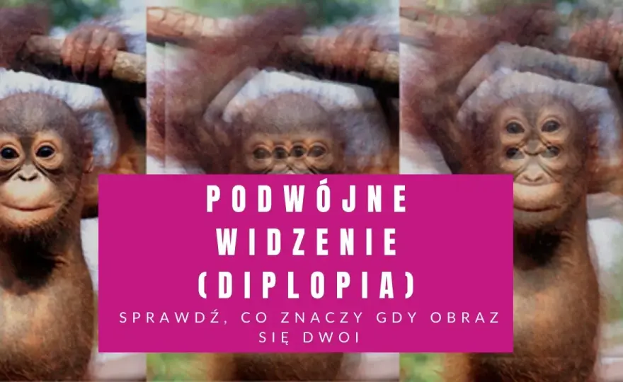 Ruch gałek ocznych - Kiedy dwojenie to sygnał alarmowy?