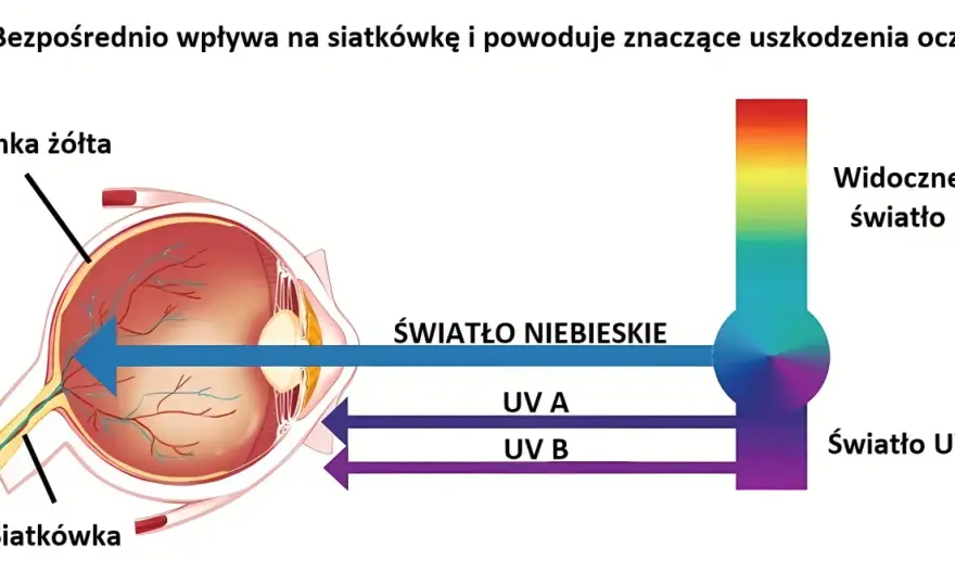 Czy telewizor emituje niebieskie światło? Sprawdź skutki dla zdrowia