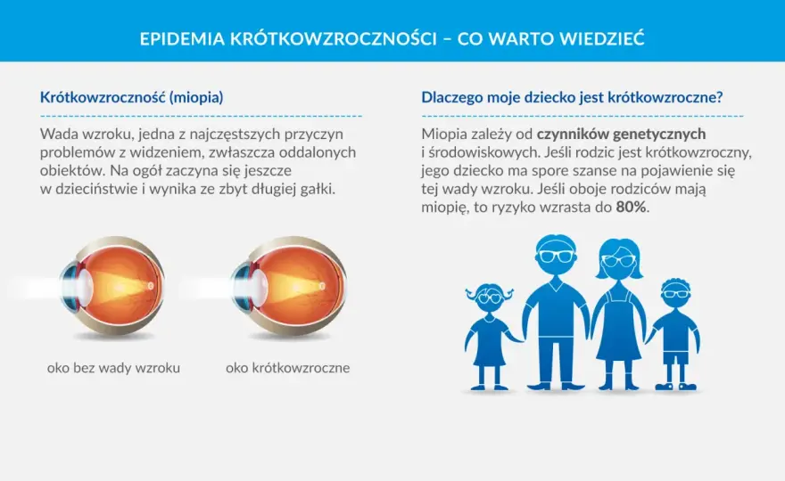 Krótkowzroczność co to? Poznaj objawy i skuteczne leczenie