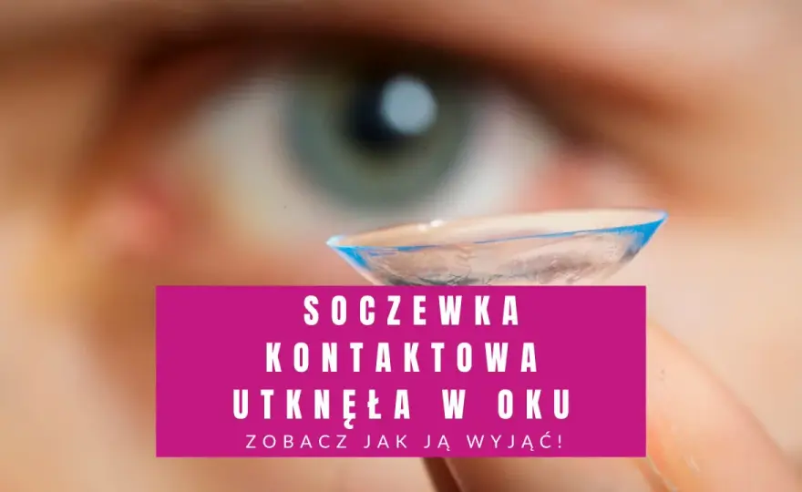 Jak bezpiecznie sprawdzić czy soczewka jest w oku - skuteczne metody kontroli