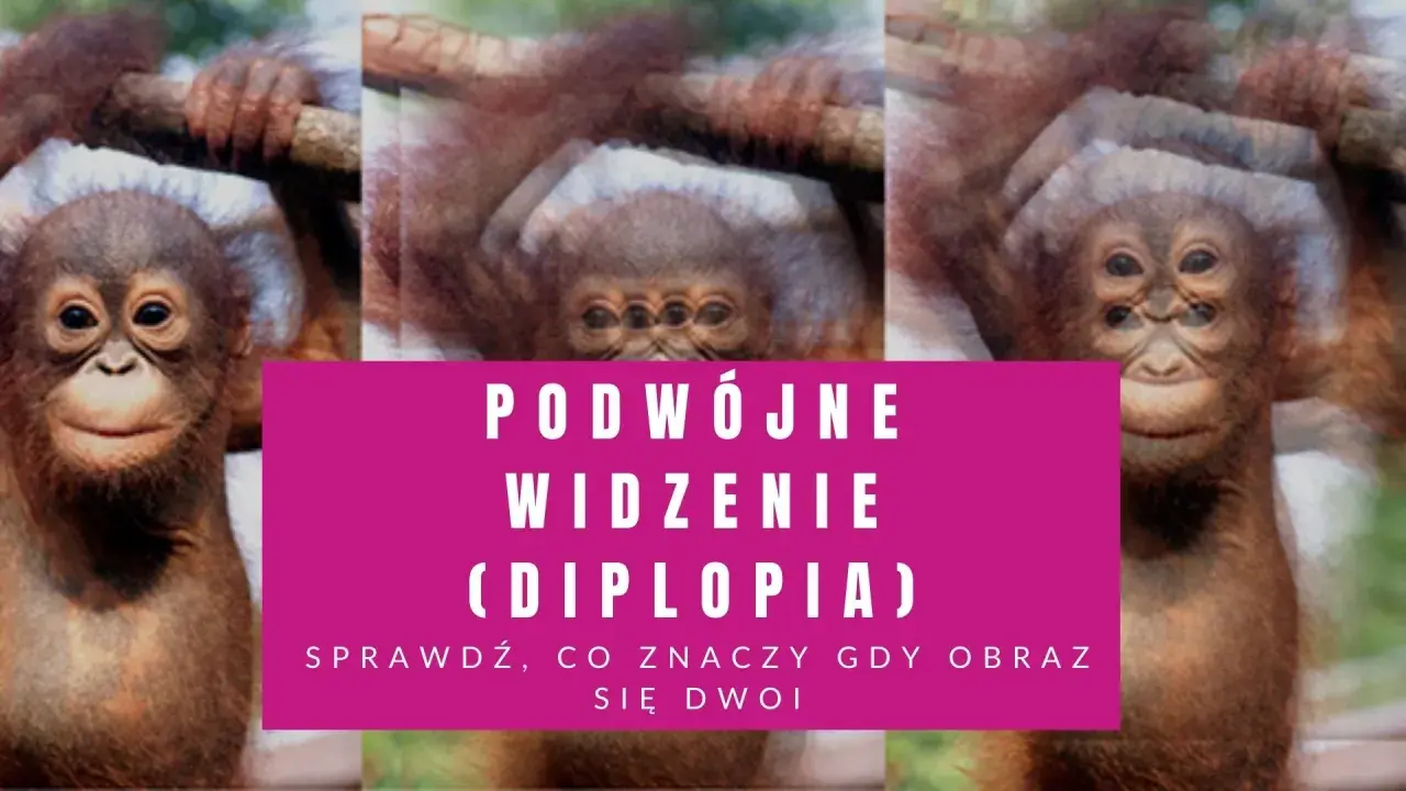 Małpka z potrójnymi oczami, sugerującymi podwójne widzenie (diplopię). Może to być spowodowane problemami z mięśniami okoruchowymi.
