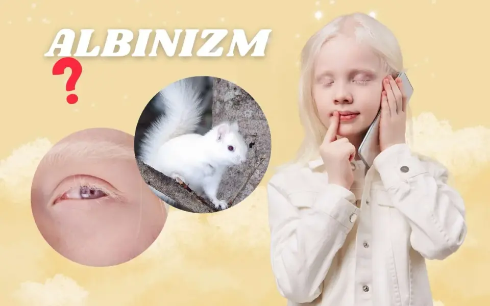 Jaki kolor oczu ma osoba z albinizmem? Wyjaśniamy